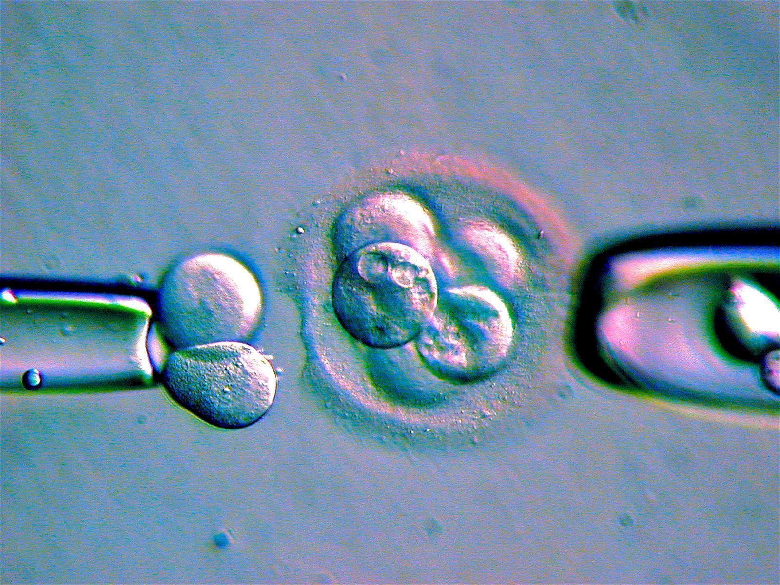 細胞分裂を繰り返す受精卵から細胞を搾取し、その染色体や遺伝子を分析する技術は夢ではなく確立された技術だ。